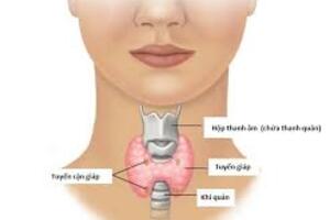 Cách nhận biết có nhân tuyến giáp