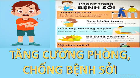 Khuyến cáo phòng chống bệnh sởi